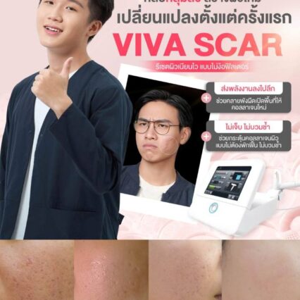 Viva Scar เลเซอร์หลุมสิว Lucrecia Clinic