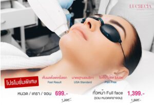 เลเซอร์กำจัดขนหนวดเคราจอน Lucrecia clinic