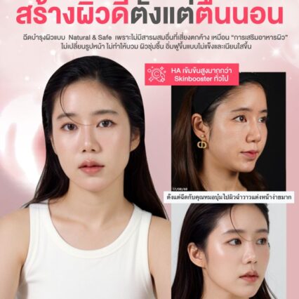 ผิวฉ่ำวาว hydrodelux neauvia lucrecia clinic