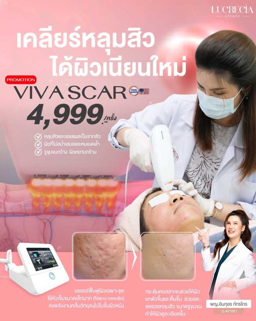 viva scar 02 100k