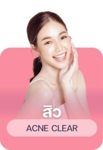 สิว acne