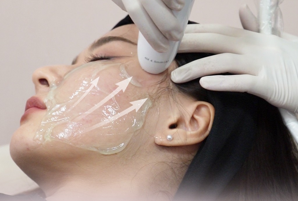 LUX กระชับหน้า รีวิว lucrecia clinic