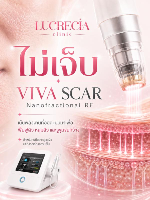 viva scar เลเซอร์หลุมสิว รูขุมขนกว้าง