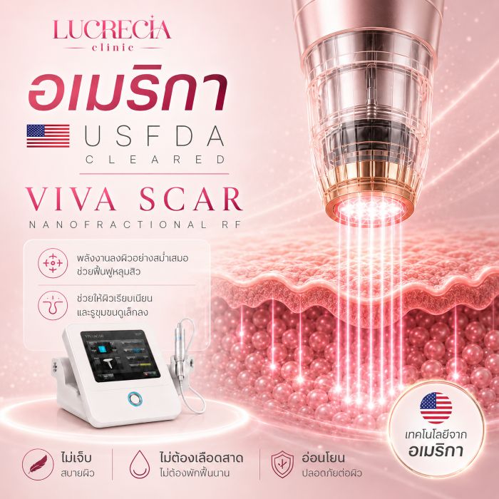 Viva scar เลเซอร์หลุมสิว